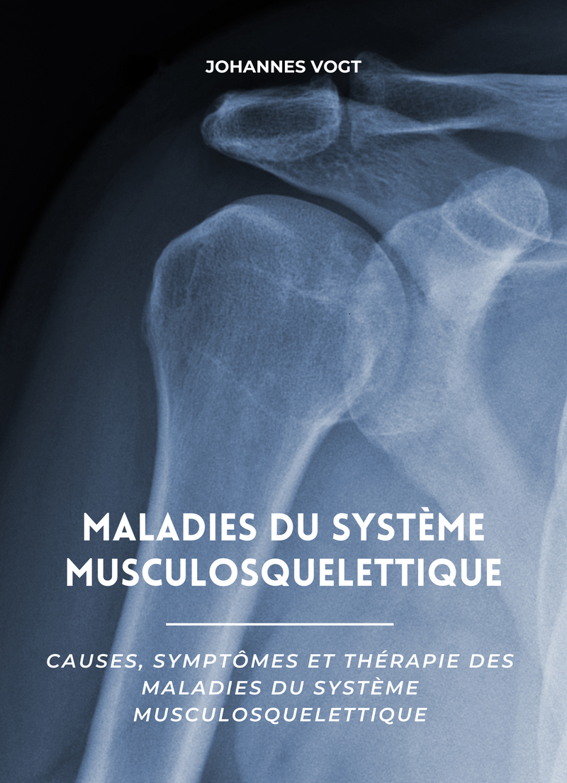 Maladies du système musculosquelettique