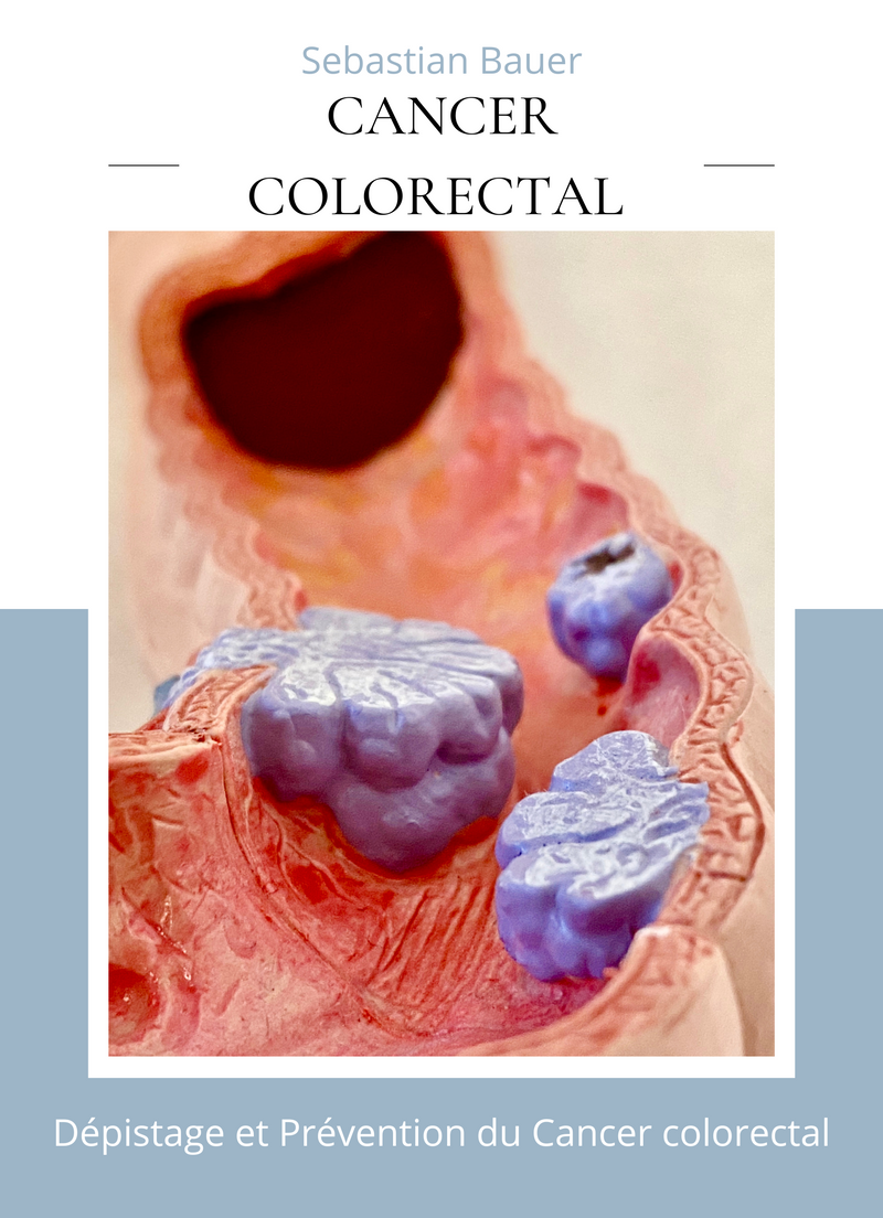 Cancer colorectal